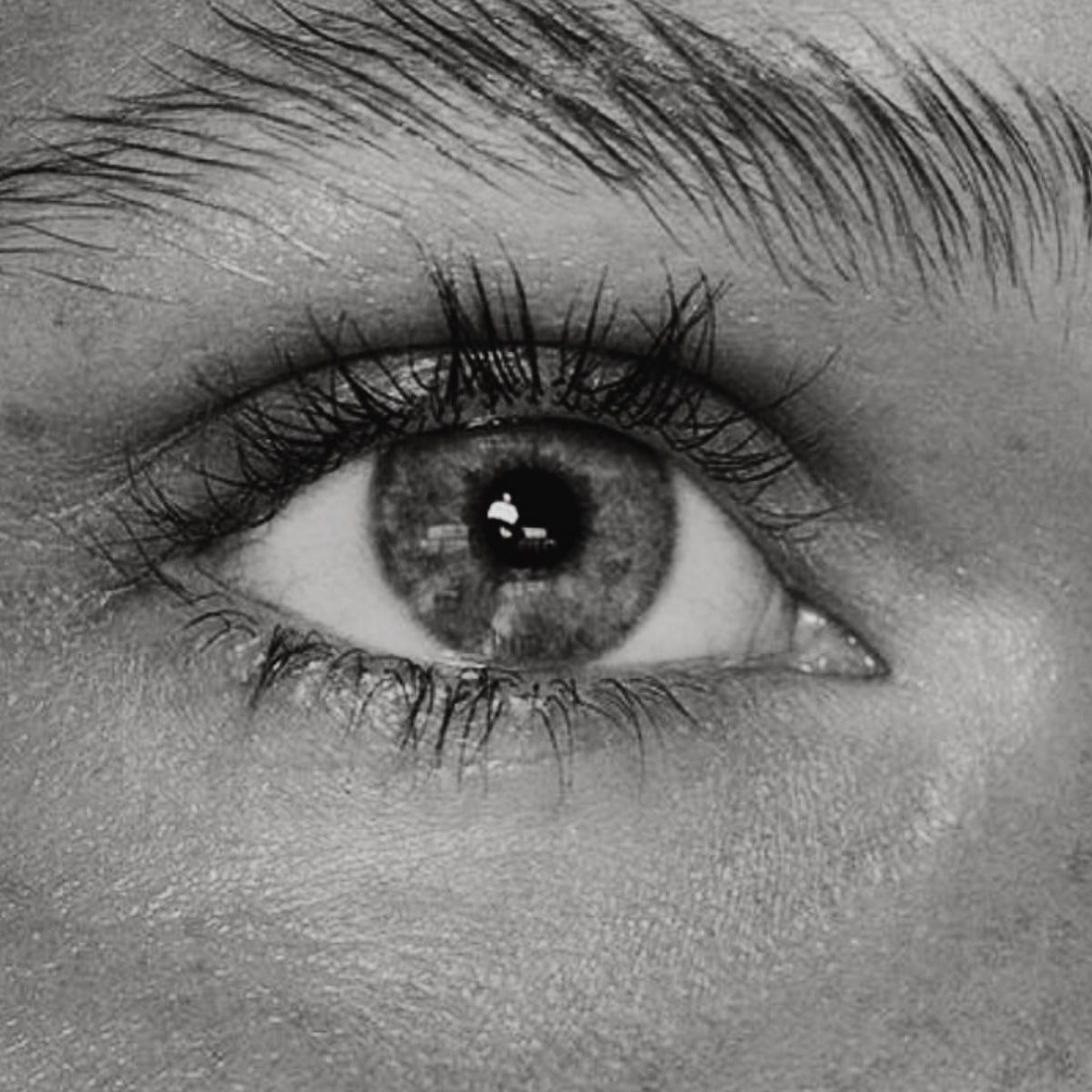 Dr. Ulaş Bali elevating brows and smoothing forehead lines with brow lift surgery for a refreshed, youthful expression.