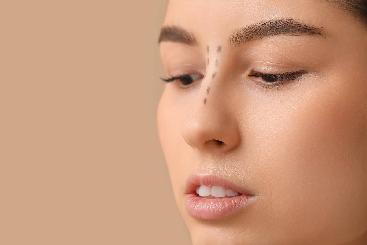 Surgical precision during rhinoplasty highlighting techniques to achieve natural and functional nasal improvements.