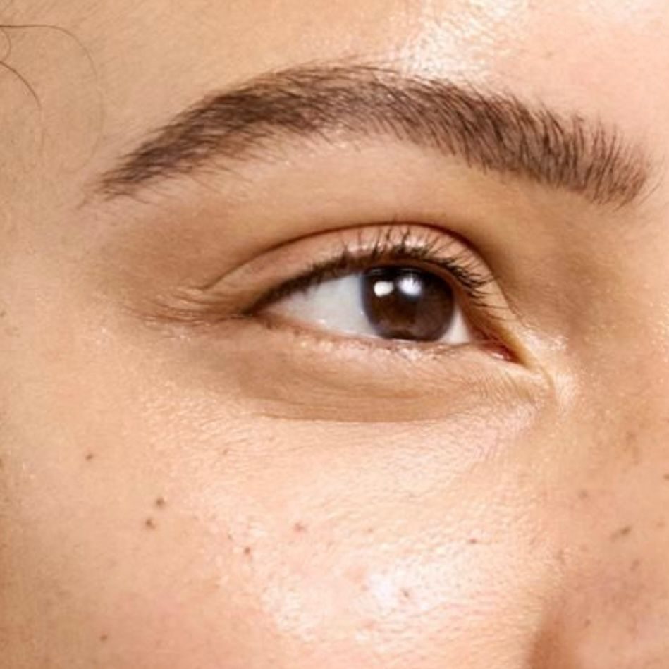 Dr. Ulaş Bali performing eyelid surgery to reduce sagging and puffiness, rejuvenating the eyes for a refreshed appearance.