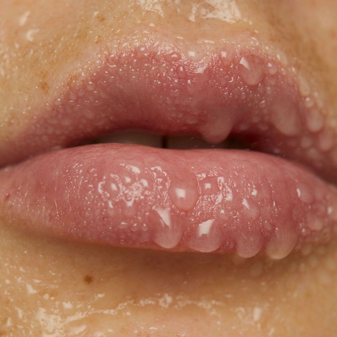 Dr. Ulaş Bali specializing in filler augmentation to restore volume, contour features, and create a balanced, rejuvenated look.