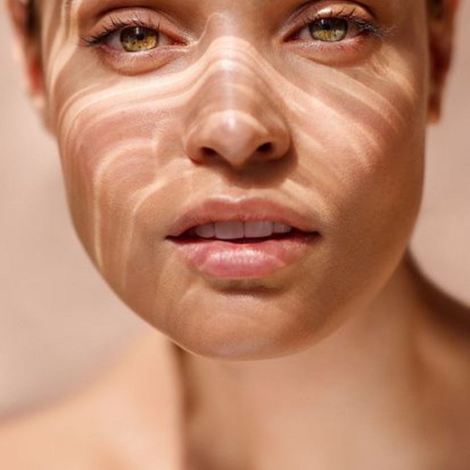 Dr. Ulaş Bali offering mesotherapy treatments to rejuvenate skin, improve hydration, and achieve a refreshed, youthful glow.