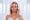 Celebrity-inspired before and after aesthetic transformation in 2025.