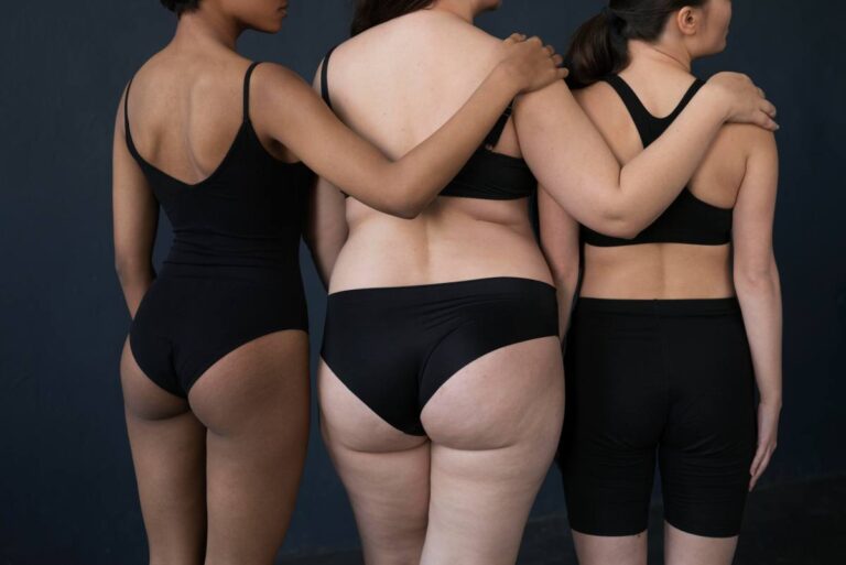 Before and after liposuction transformation focused on abdominal contouring.