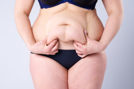 Dr. Ulas Bali planning a customized mommy makeover consultation with a patient.