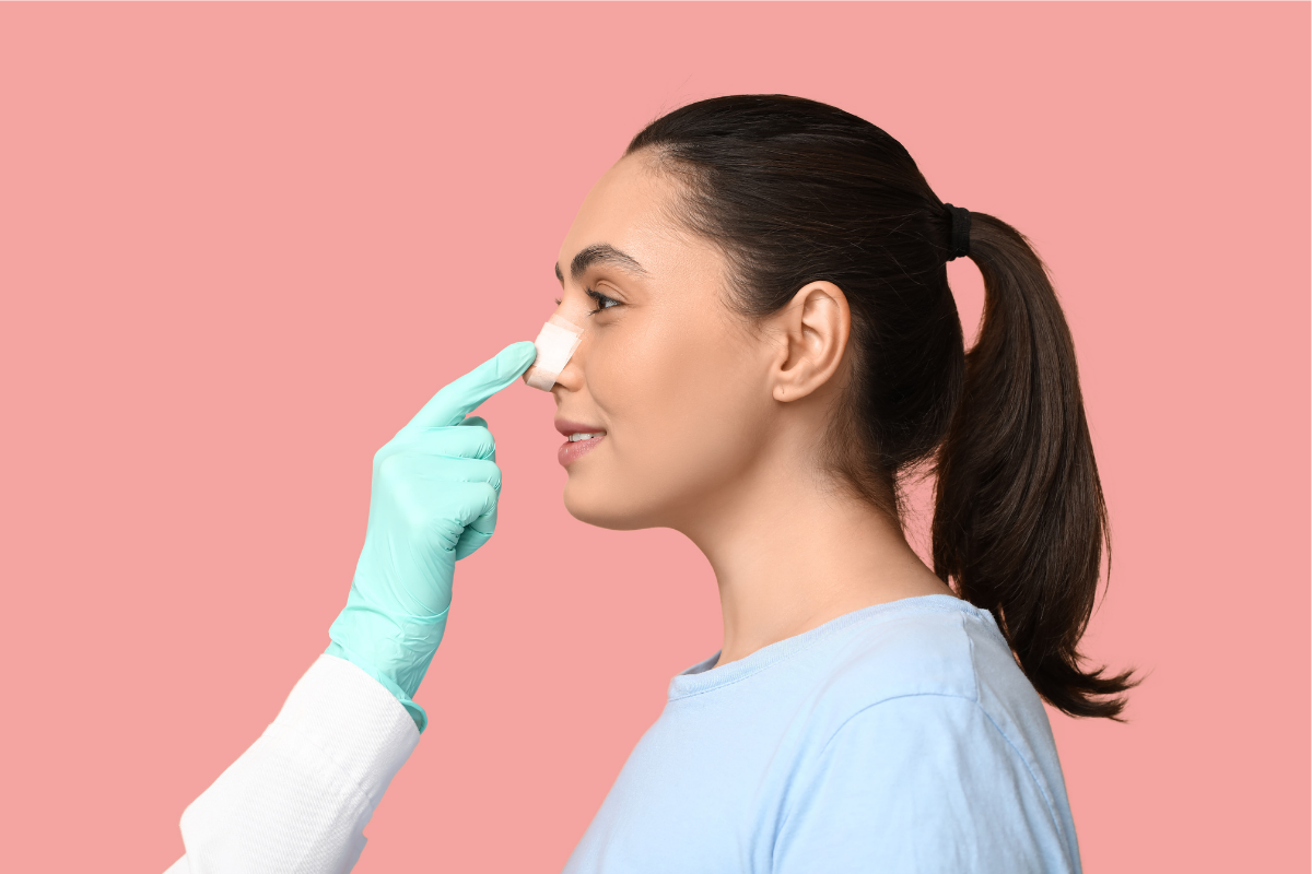 Close-up of post-op nose swelling during the healing timeline.