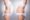 Smooth, contoured female waistline showcasing Liposuction 360 results.